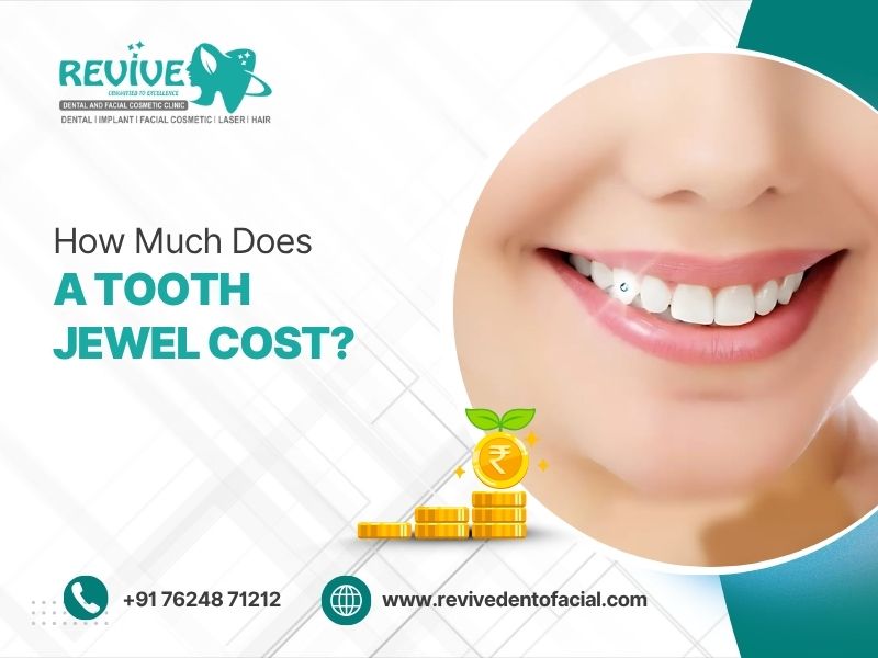 How Much Does a Tooth Jewel Cost?