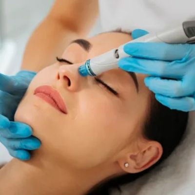 hydrafacial treatment in rajajinagar